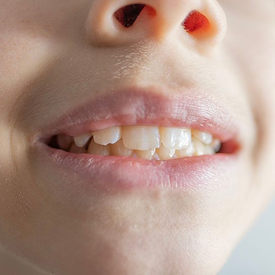 - Young Dentistry for Children
