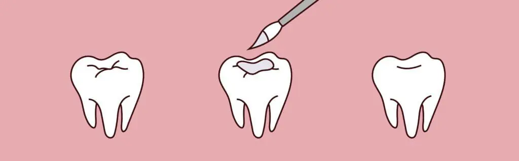 - Young Dentistry for Children