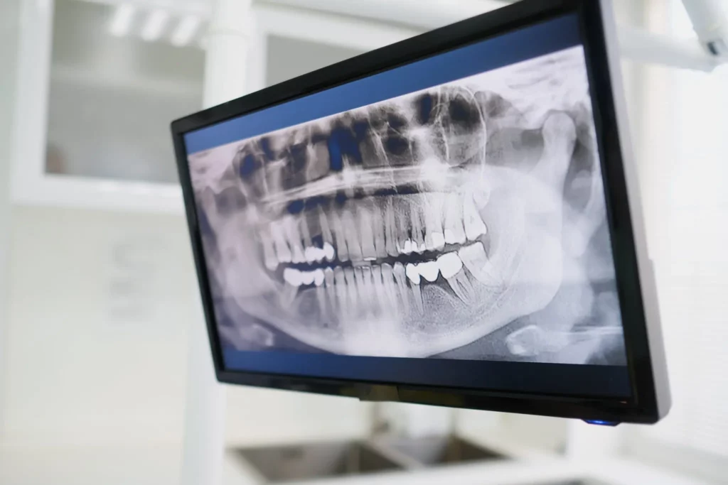 - Young Dentistry for Children